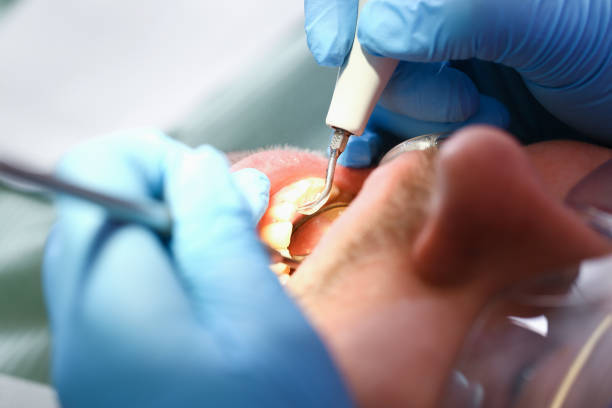 Best Pediatric Emergency Dentist in Portland, IN